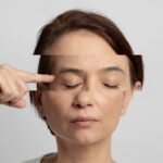 Skin Burnout: quando sua pele está tão estressada quanto você