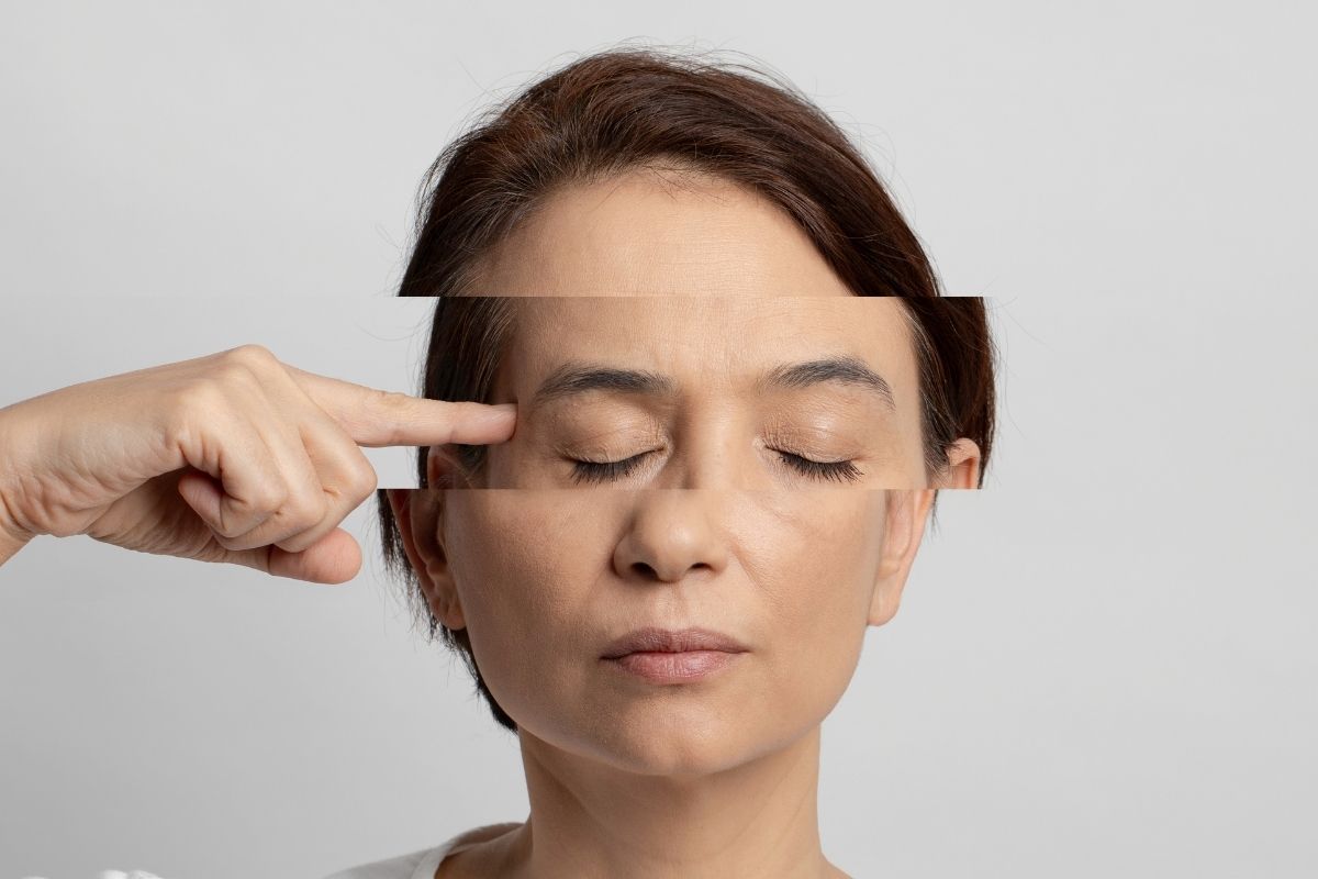 skin burnout