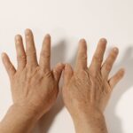 Mãos envelhecidas: como rejuvenescer as mãos com segurança